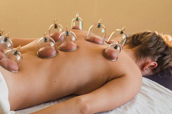 cupping Therapy